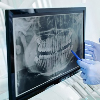 Holliston orthodontist pointing to patient's X-ray on screen