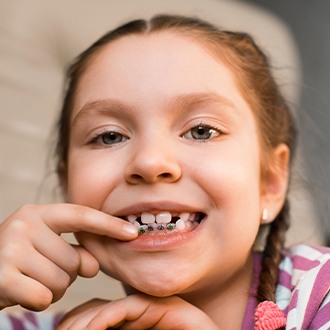 Young girl pointing to her pediatric orthodontics appliance