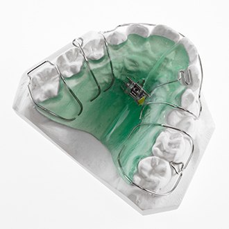 Pediatric orthodontic appliance on model smile