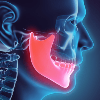 3 D animation of jaw and skull bone prior to dentofacial orthopedics treatment